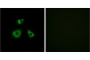 Immunofluorescence analysis of HuvEc cells, using MRPL52 Antibody.