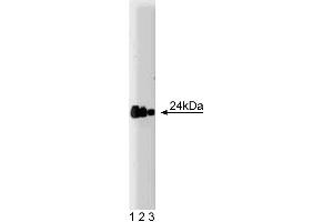 Western blot analysis of FADD on a A431 lysate. (FADD anticorps  (AA 94-208))