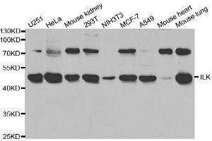 Western blot analysis of extracts of various cell lines, using ILK antibody. (ILK anticorps  (AA 1-260))