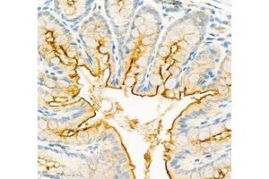 Immunohistochemistry of paraffin embedded mouse rectum using CEACAM1 (ABIN7073315) at dilution of 1: 650 (400x lens)