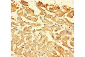 Immunohistochemistry of paraffin-embedded human heart tissue using ABIN7146926 at dilution of 1:100