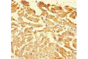 Immunohistochemistry of paraffin-embedded human heart tissue using ABIN7146926 at dilution of 1:100 (Caspase 1 anticorps  (AA 120-269))
