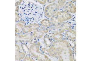 Immunohistochemistry of paraffin-embedded rat kidney using DCP2 antibody at dilution of 1:100 (x40 lens). (DCP2 anticorps)