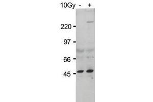 Anti-ATM Monoclonal Antibody - Western Blot. (ATM anticorps  (pSer1981) (HRP))