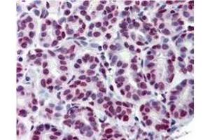 Immunohistochemistry of Monoclonal Anti-Stat5 pY694 Antibody.