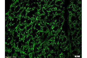 Formalin-fixed and paraffin embedded rat spinal cord labeled with Rabbit Anti-NF-H/Neurofilament H/Neurofilament 200 Polyclonal Antibody (ABIN672156), Unconjugated 1:200 followed by conjugation to the secondary antibody and DAB staining.