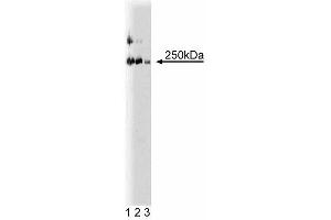 Western blot analysis of LR11 on a rat cerebrum lysate. (SORL1 anticorps  (AA 1220-1337))