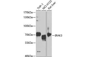 Western blot analysis of extracts of various cell lines, using IR antibody (ABIN6130501, ABIN6142519, ABIN6142521 and ABIN6221129) at 1:1000 dilution. (IRAK3 anticorps  (AA 367-596))