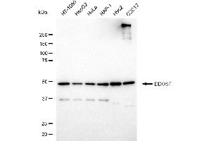 Western blotting analysis using DDOST antibody (ABIN7798383).