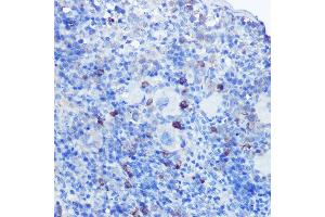 Immunohistochemistry of paraffin-embedded mouse spleen using TLR9 Rabbit pAb (ABIN7270849) at dilution of 1:100 (40x lens). (TLR9 anticorps  (AA 350-450))