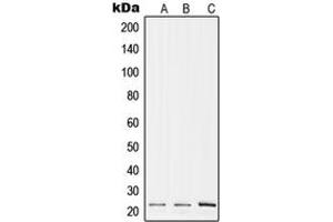 Western blot analysis of RPL17 expression in A375 (A), Raw264.