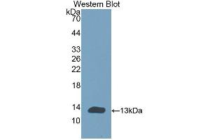 Detection of Recombinant CHRNa1, Human using Polyclonal Antibody to Cholinergic Receptor, Nicotinic, Alpha 1 (CHRNa1) (CHRNA1 anticorps  (AA 21-255))