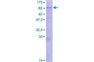 Image no. 1 for Coagulation Factor XI (F11) (AA 1-625) protein (GST tag) (ABIN1353293)