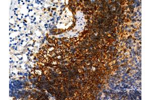 Phospho-ZO-2 (Tyr1118) Antibody at 1/100 staining Rat spleen tissue by IHC-P. (TJP2 anticorps  (pTyr1118))