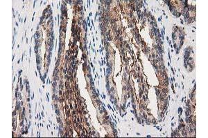 Image no. 1 for anti-Annexin A3 (ANXA3) antibody (ABIN1496642)