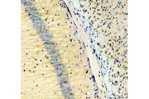 IHC analysis of NFIA using anti-NFIA antibody (ABIN4886680).