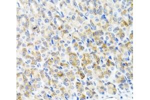 Immunohistochemistry of paraffin-embedded Mouse stomach using RAD51C Polyclonal Antibody at dilution of 1:100 (40x lens). (RAD51C anticorps)
