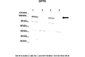 Lanes:   Lane 1: 20ug mouse WT brain extract  Lnae 2: DPP6 -/- mouse brain extract  Lane 3: 20ug mouse WT brain extract  4: DPP6 -/- mouse brain extract  Primary Antibody Dilution:   1:1000  Secondary Antibody:   Donkey anti-rabbit-HRP  Secondary Antibody Dilution:   1:10,000  Gene Name:   DPP6 a  Submitted by:   Jeanne M. (DPP6 anticorps  (Middle Region))