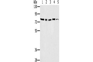 Western Blotting (WB) image for anti-TGF-beta Activated Kinase 1/MAP3K7 Binding Protein 3 (TAB3) antibody (ABIN2423761) (TAB3 anticorps)