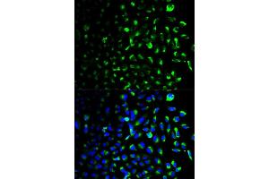 Immunofluorescence analysis of U2OS cell using HK1 antibody. (Hexokinase 1 anticorps)