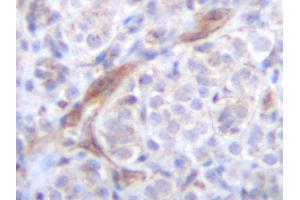 Immunohistochemistry (IHC) image for anti-Tumor Necrosis Factor (Ligand) Superfamily, Member 10 (TNFSF10) antibody (ABIN2479502) (TRAIL anticorps)