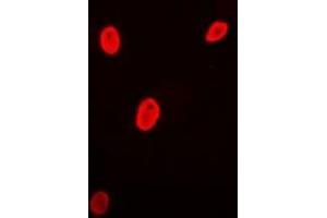 Immunofluorescent analysis of Brn-5 staining in MCF7 cells. (POU6F1 anticorps)