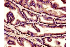 Immunohistochemistry of paraffin-embedded human prostate tissue using ABIN7148337 at dilution of 1:100