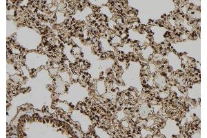 ABIN6277425 at 1/100 staining Rat lung tissue by IHC-P. (PDX1 anticorps  (Internal Region))