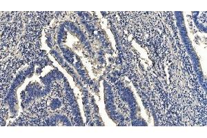 IHC analysis of HYI using anti-HYI antibody (ABIN7601796). (HYI anticorps  (AA 46-277))