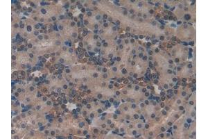 Detection of ND5 in Rat Kidney Tissue using Polyclonal Antibody to NADH Dehydrogenase 5 (ND5)