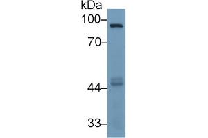 Detection of MMP9 in Human HepG2 cell lysate using Monoclonal Antibody to Matrix Metalloproteinase 9 (MMP9)