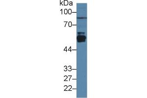 Western Blot; Sample: Rat Liver lysate; Primary Ab: 3µg/ml Rabbit Anti-Rat CYP2E1 Antibody Second Ab: 0. (CYP2E1 anticorps  (AA 126-309))