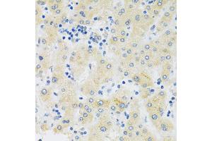 Immunohistochemistry of paraffin-embedded human liver using SLC39A7 antibody (ABIN5971725) at dilution of 1/100 (40x lens). (SLC39A7 anticorps)