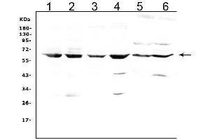 Western blot analysis of LBP using anti-LBP antibody (ABIN5519024).