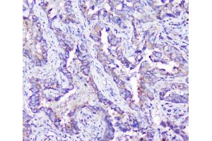 IHC analysis of ARSA using anti-ARSA antibody (ABIN5692787). (Arylsulfatase A anticorps  (C-Term))