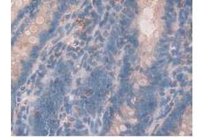 IHC-P analysis of Rat Intestine Tissue, with DAB staining. (Growth Hormone Receptor anticorps  (AA 353-588))
