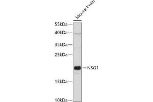 anti-Neuron-Specific Protein Family Member 1 (D4S234E) (AA 1-80) antibody