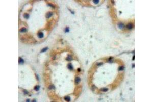 Used in DAB staining on fromalin fixed paraffin-embedded Kidney tissue