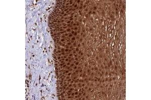 Immunohistochemical staining of human esophagus with DHX38 polyclonal antibody  shows strong cytoplasmic and nuclear positivity in squamous epithelial cells at 1:50-1:200 dilution. (DHX38 anticorps)