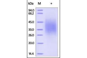SDS-PAGE (SDS) image for Interleukin 18 Binding Protein (IL18BP) (AA 31-194) protein (His tag) (ABIN2181348)