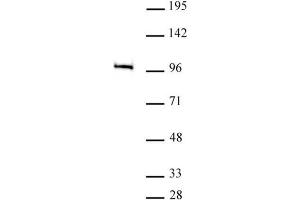 MED15 antibody (pAb) tested by Immunoprecipitation. (MED15 anticorps  (C-Term))