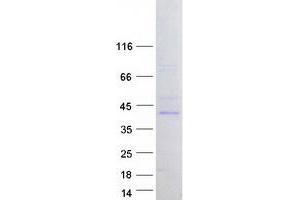 Validation with Western Blot