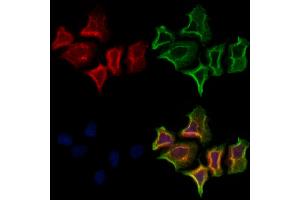 ABIN6261709 and ABIN6273117 staining Hela cells by IF/ICC. (FECH anticorps  (C-Term))