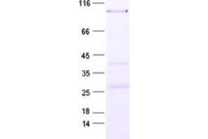 Validation with Western Blot (HIC2 Protein (His tag))