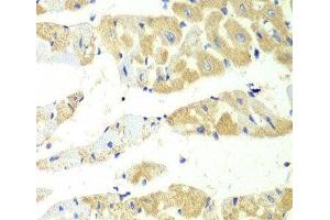 Immunohistochemistry of paraffin-embedded Mouse heart using TBXAS1 Polyclonal Antibody at dilution of 1:100 (40x lens). (TBXAS1 anticorps)