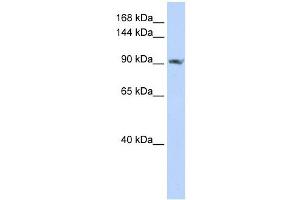 SCUBE2 antibody used at 1 ug/ml to detect target protein. (SCUBE2 anticorps  (C-Term))
