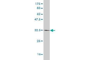 Western Blot detection against Immunogen (34. (HAND2 anticorps  (AA 135-216))