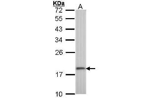 WB Image Sample (30 ug of whole cell lysate) A: A431 , 12% SDS PAGE antibody diluted at 1:1000 (RPS10 anticorps)