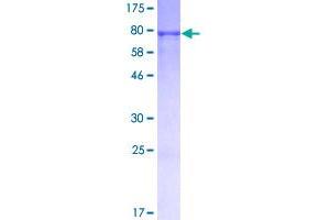 Image no. 1 for Interferon Regulatory Factor 3 (IRF3) protein (GST tag) (ABIN1308082)
