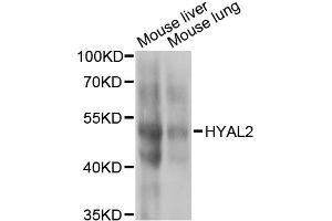 Western blot analysis of extracts of various cell lines, using HYAL2 antibody (ABIN2563308) at 1:1000 dilution. (HYAL2 anticorps)